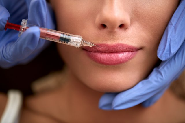 Dermal Fillers | Aesthetics Treatments Oxford gallery image 2