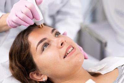 Client receiving medical microneedling treatment in aesthetic clinic.